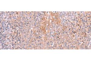 Immunohistochemistry of paraffin-embedded Human tonsil tissue using ZSWIM1 Polyclonal Antibody at dilution of 1:55(x200)