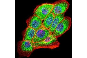 Image no. 5 for anti-Polycystic Kidney and Hepatic Disease 1 Protein (PKHD1) (AA 3878-4060) antibody (ABIN5542352)