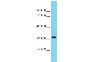 Image no. 1 for anti-Meteorin, Glial Cell Differentiation Regulator-Like (METRNL) (C-Term) antibody (ABIN2791385)