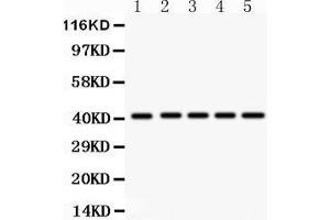 Image no. 1 for anti-Homeobox A10 (HOXA10) (AA 57-340) antibody (ABIN3042453)