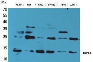 Image no. 1 for anti-Thioredoxin Domain Containing 17 (TXNDC17) (Tyr796) antibody (ABIN3187679)