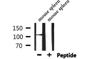 Image no. 1 for anti-Dihydropyrimidine Dehydrogenase (DPYD) (Internal Region) antibody (ABIN6261361)