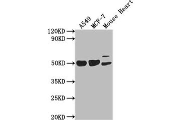 SLIT-ROBO rho GTPase Activating Protein 2B (SRGAP2B) (AA 79-150) anticorps