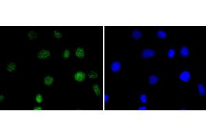 Image no. 1 for anti-Interferon Regulatory Factor 2 (IRF2) antibody (ABIN5557494)