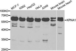 Image no. 1 for anti-Karyopherin alpha 1 (Importin alpha 5) (KPNA1) antibody (ABIN6142989)