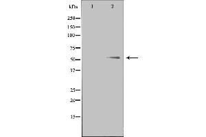 Image no. 1 for anti-Parathyroid Hormone 1 Receptor (PTH1R) (pThr1) antibody (ABIN6257431)