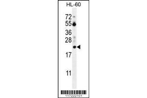 Image no. 2 for anti-Prothymosin, alpha (PTMA) (AA 1-31), (N-Term) antibody (ABIN655715)