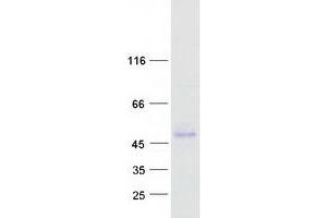 Image no. 1 for serpin Peptidase Inhibitor, Clade F (Alpha-2 Antiplasmin, Pigment Epithelium Derived Factor), Member 1 (SERPINF1) protein (Myc-DYKDDDDK Tag) (ABIN2731834)