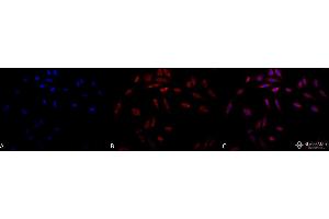 Image no. 3 for anti-serpin Peptidase Inhibitor, Clade H (Heat Shock Protein 47), Member 1, (Collagen Binding Protein 1) (SERPINH1) antibody (FITC) (ABIN2484373)