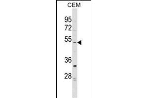 EVI2B Antibody (Center) (ABIN1538239 and ABIN2849160) western blot analysis in CEM cell line lysates (35 μg/lane).
