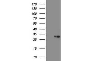 Image no. 2 for anti-Prefoldin Subunit 3 (PFDN3) antibody (ABIN1501700)