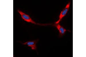 Immunofluorescent analysis of BMP8A staining in A549 cells.