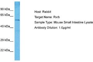 Image no. 2 for anti-Retinoid X Receptor, beta (RXRB) (N-Term) antibody (ABIN2774660)