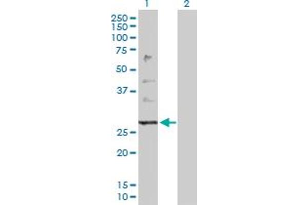 anti-Protein Tyrosine Phosphatase-Like (Proline Instead of Catalytic Arginine), Member B (PTPLB) (AA 1-254) antibody