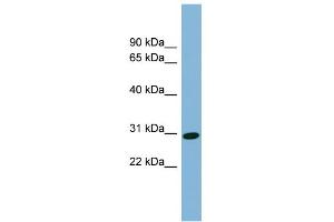 WB Suggested Anti-CENPQ Antibody Titration: 0.