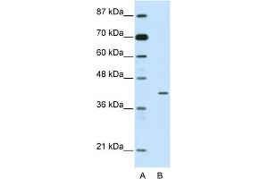 Image no. 1 for anti-Homeobox Containing 1 (HMBOX1) (N-Term) antibody (ABIN2781213)