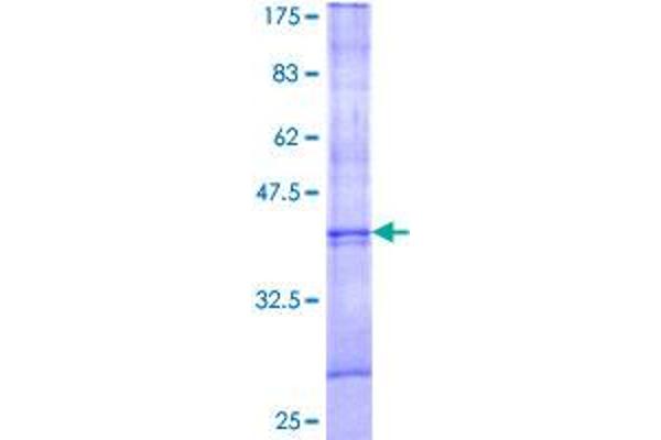 UXT Protein (AA 10-100) (GST tag)