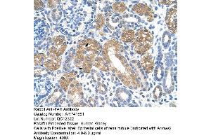 Image no. 5 for anti-Fumarylacetoacetate Hydrolase (Fumarylacetoacetase) (FAH) (C-Term) antibody (ABIN2776935)