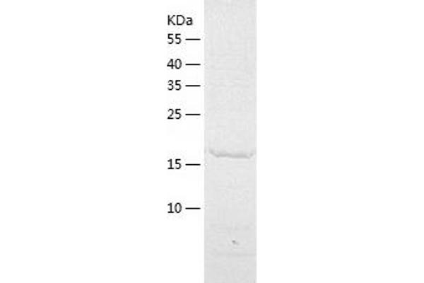 PMVK Protein (AA 1-192) (His tag)