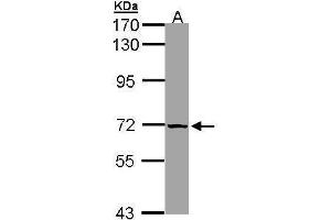 Image no. 3 for anti-Solute Carrier Family 25, Member 13 (Citrin) (slc25a13) (Internal Region) antibody (ABIN2856647)