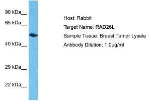 Image no. 1 for anti-Excision Repair Cross-Complementing Rodent Repair Deficiency, Complementation Group 6-Like 2 (ERCC6L2) (N-Term) antibody (ABIN2785695)