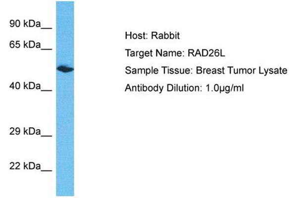 anti-Excision Repair Cross-Complementing Rodent Repair Deficiency, Complementation Group 6-Like 2 (ERCC6L2) (N-Term) antibody