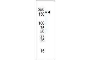 Image no. 1 for anti-Insulin Receptor (INSR) (AA 28-57), (N-Term) antibody (ABIN392002)