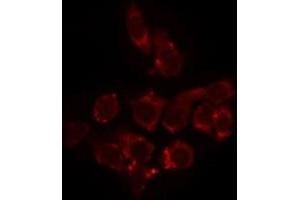 Image no. 1 for anti-Solute Carrier Family 25 (Mitochondrial Carrier, Oxoglutarate Carrier), Member 11 (SLC25A11) antibody (ABIN6259189)