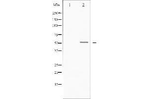 Image no. 2 for anti-Vitamin D Receptor (VDR) (pSer208) antibody (ABIN6255086)
