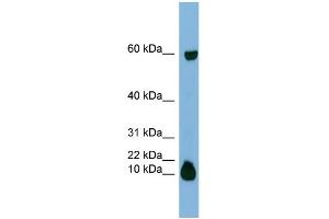 Image no. 1 for anti-Statherin (STATH) (Middle Region) antibody (ABIN2777143)