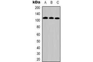 Image no. 1 for anti-Dihydropyrimidine Dehydrogenase (DPYD) (Center) antibody (ABIN3066747)