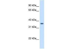 Image no. 1 for anti-Aldo-Keto Reductase Family 1, Member B10 (Aldose Reductase) (AKR1B10) (N-Term) antibody (ABIN2775474)