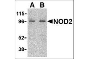Image no. 2 for anti-Nucleotide-Binding Oligomerization Domain Containing 2 (NOD2) (C-Term) antibody (ABIN500365)