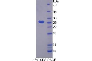 Image no. 1 for Prostaglandin D2 Synthase (PTGDS) (AA 1-199) protein (His tag) (ABIN6237741)