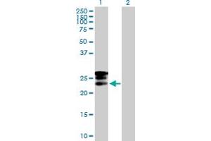 Image no. 5 for anti-GrpE-Like 1, Mitochondrial (GRPEL1) (AA 1-217) antibody (ABIN529247)