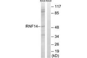 Image no. 1 for anti-Ring Finger Protein 14 (RNF14) (AA 361-410) antibody (ABIN1534869)