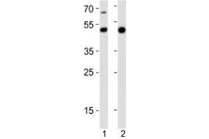 Image no. 1 for anti-GATA Binding Protein 6 (GATA6) (AA 544-577), (C-Term) antibody (ABIN3028675)