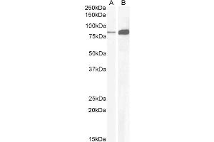 Image no. 4 for anti-Cholecystokinin B Receptor (CCKBR) (Internal Region) antibody (ABIN185407)