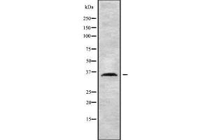 Image no. 1 for anti-Homeobox D13 (HOXD13) (Internal Region) antibody (ABIN6262355)