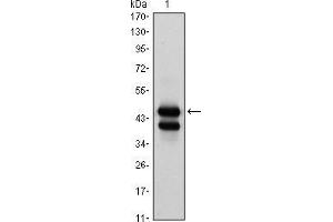 Image no. 3 for anti-GATA Binding Protein 1 (Globin Transcription Factor 1) (GATA1) antibody (ABIN969166)
