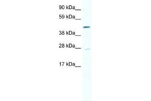 Image no. 1 for anti-SET and MYND Domain Containing 1 (SMYD1) (N-Term) antibody (ABIN927654)