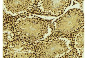 Image no. 2 for anti-Protein Inhibitor of Activated STAT, 4 (PIAS4) (C-Term) antibody (ABIN6264199)