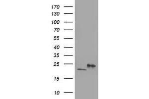 Image no. 2 for anti-Dihydrofolate Reductase-Like 1 (DHFRL1) (AA 4-185) antibody (ABIN2719444)