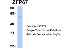 Image no. 4 for anti-Zinc Finger and BTB Domain Containing 7B (ZBTB7B) (Middle Region) antibody (ABIN2777563)