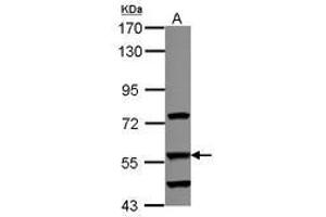 Image no. 2 for anti-Dihydrouridine Synthase 2-Like (DUS2L) (AA 1-199) antibody (ABIN1497929)