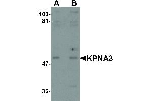 Image no. 1 for anti-Karyopherin alpha 3 (Importin alpha 4) (KPNA3) antibody (ABIN6657022)