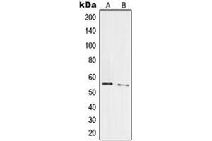 Image no. 2 for anti-Pre-mRNA Processing Factor 19 (PRPF19) (Center) antibody (ABIN2706878)