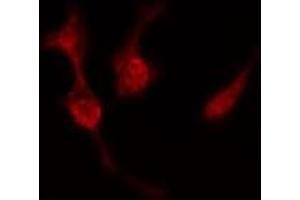Image no. 3 for anti-Protein Kinase, CAMP Dependent, Catalytic, beta (PRKACB) (C-Term) antibody (ABIN6264422)