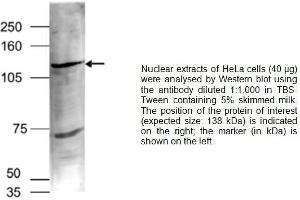 Image no. 1 for anti-Euchromatic Histone-Lysine N-Methyltransferase 1 (EHMT1) (Center) antibody (ABIN2486992)