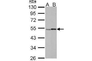 Retinoic Acid Receptor gamma Antikörper  (Center)